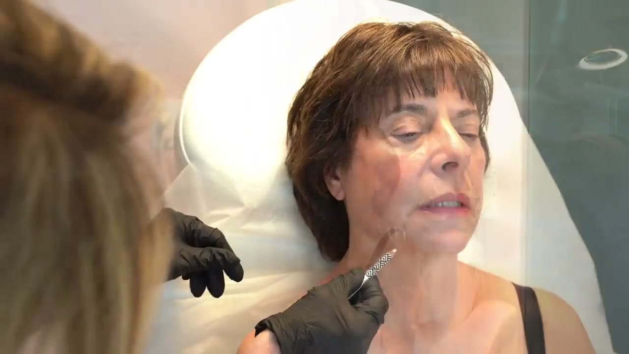 Face services at Skin and Self Med Spa - Skin Rejuvenation
